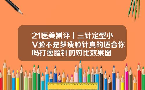 21医美测评丨三针定型小V脸不是梦瘦脸针真的适合你吗打瘦脸针的对比效果图